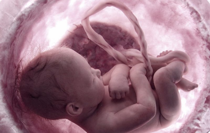 cordao-umbilical-cordvida